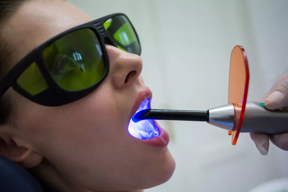 blanqueamiento dental casero