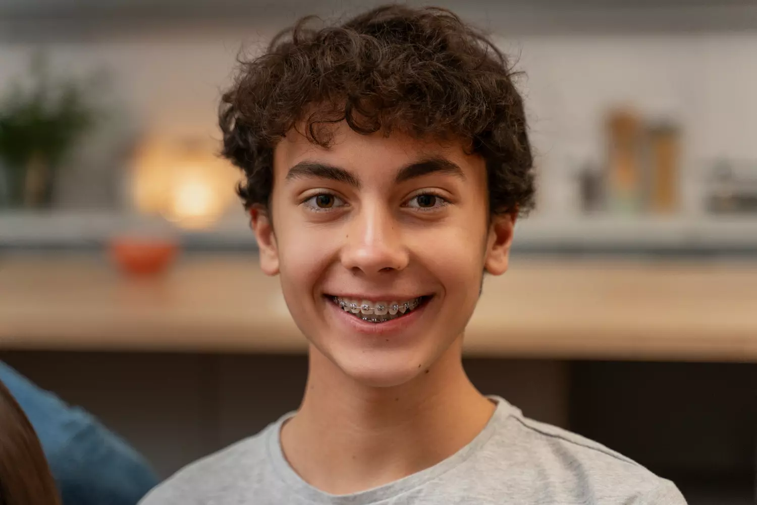 dientes después de ortodoncia